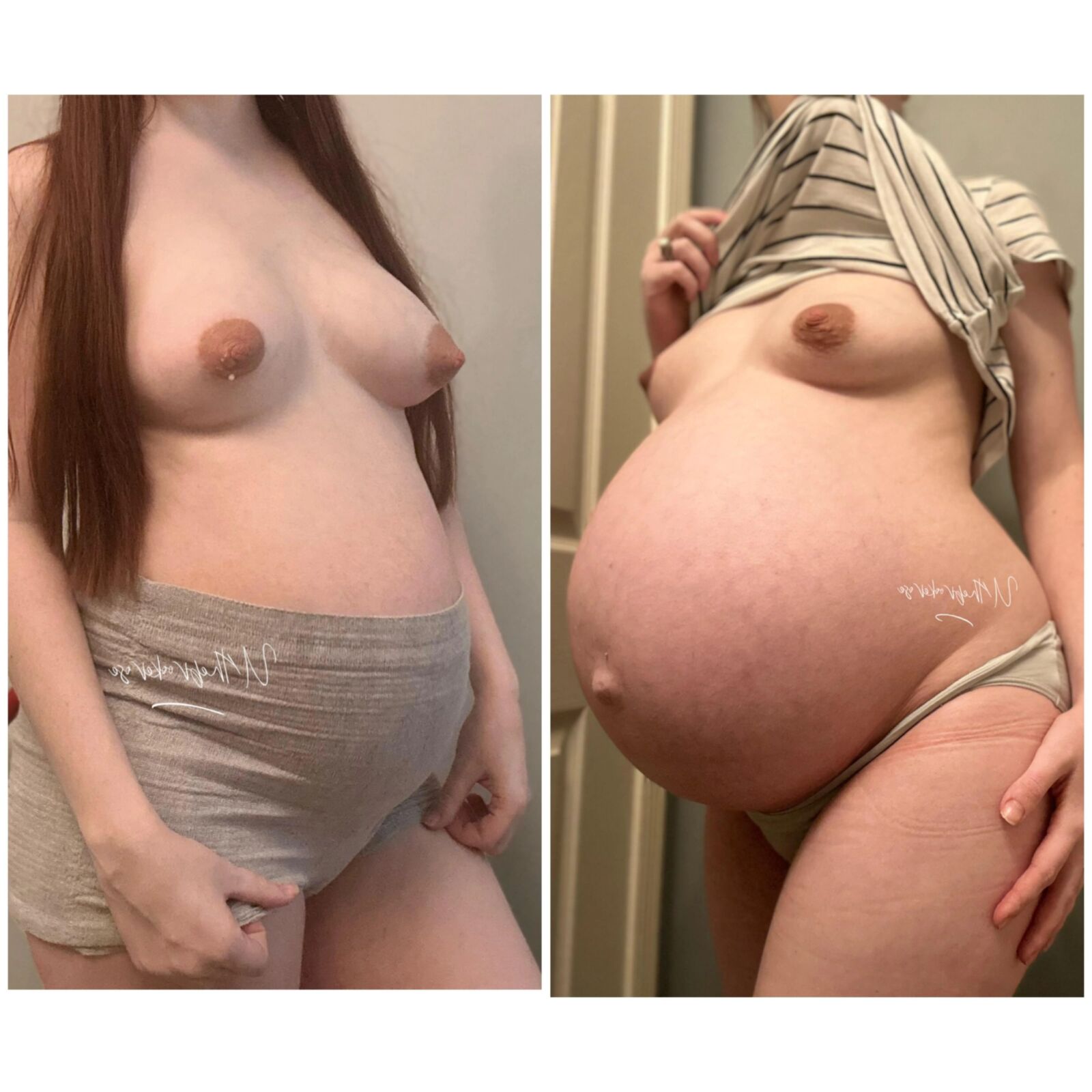 Reddit collection after and before pregnancy 