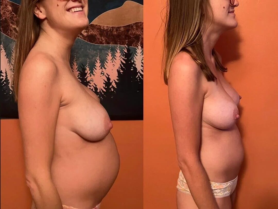 Reddit collection after and before pregnancy 3l