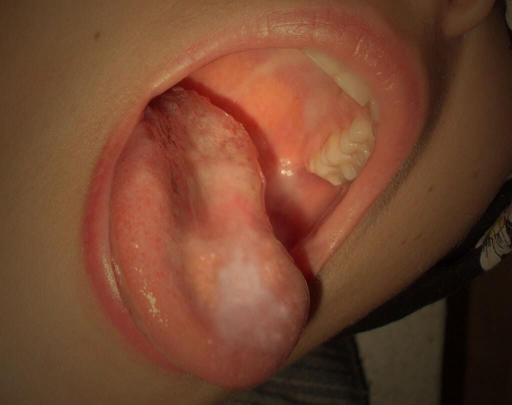 fickstück