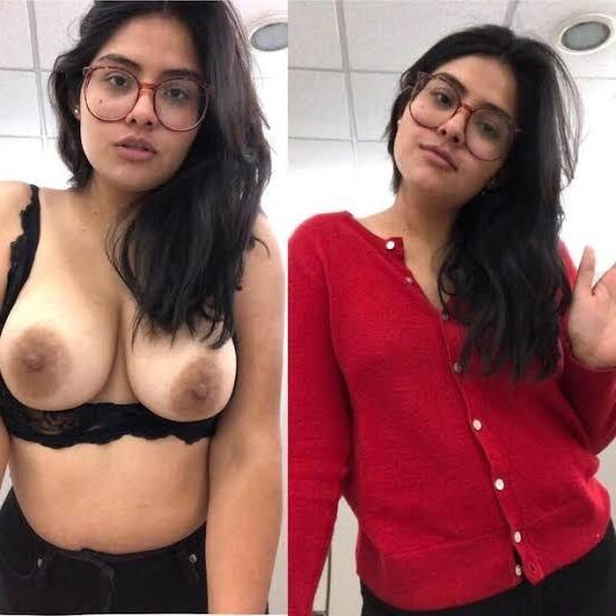 Before After 
