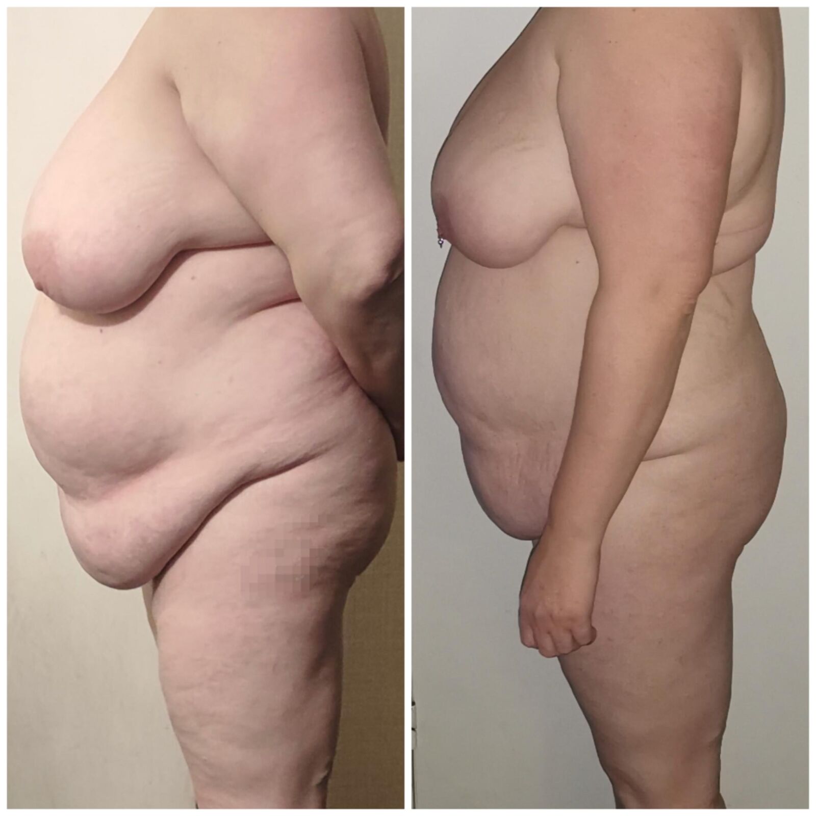 BBW Wife Comparrison