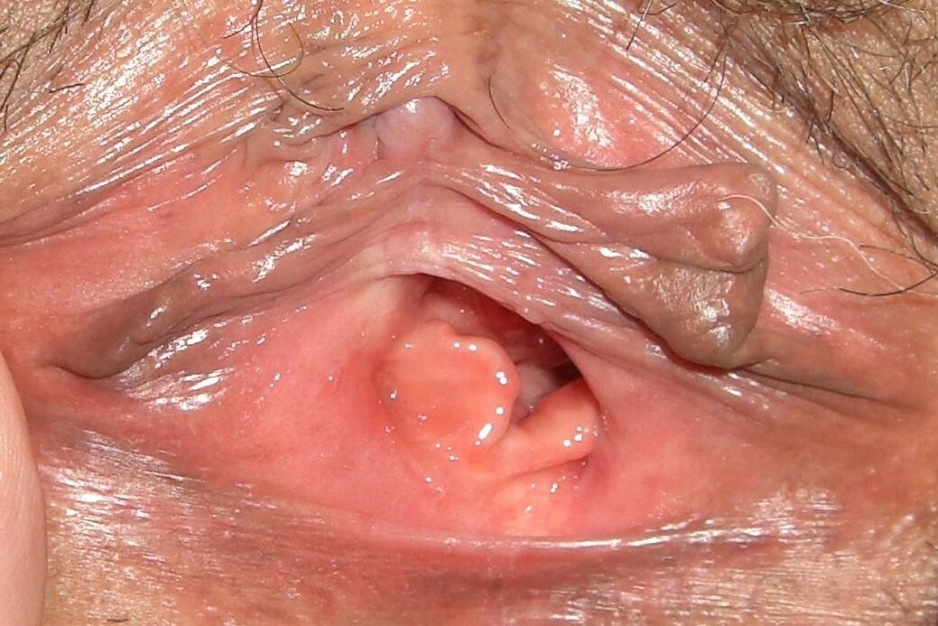 close up