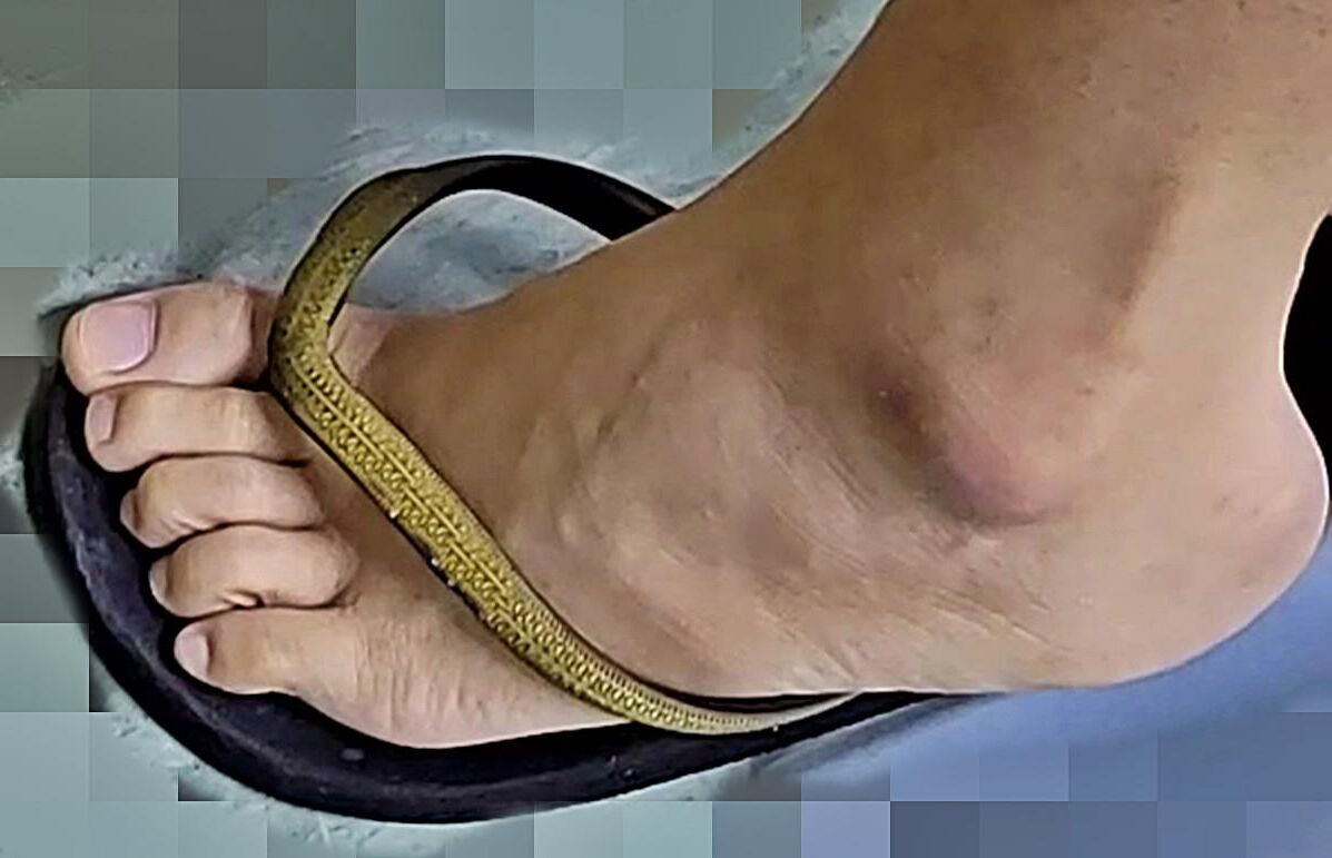 Beautiful Yummy Feet and Sexy Legs 