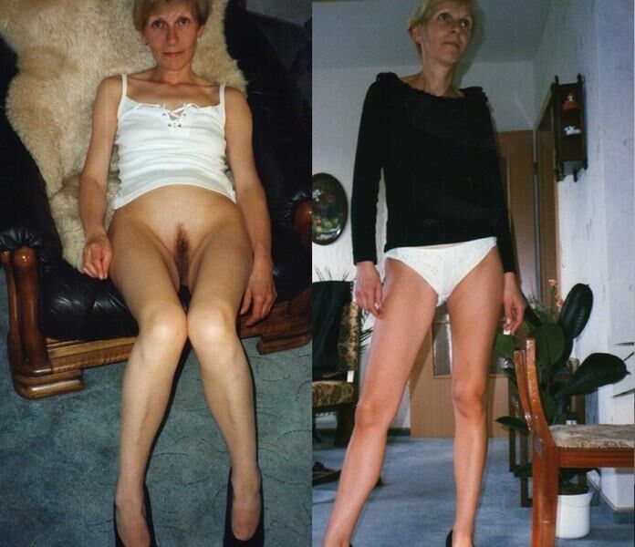 Before and After OMG 