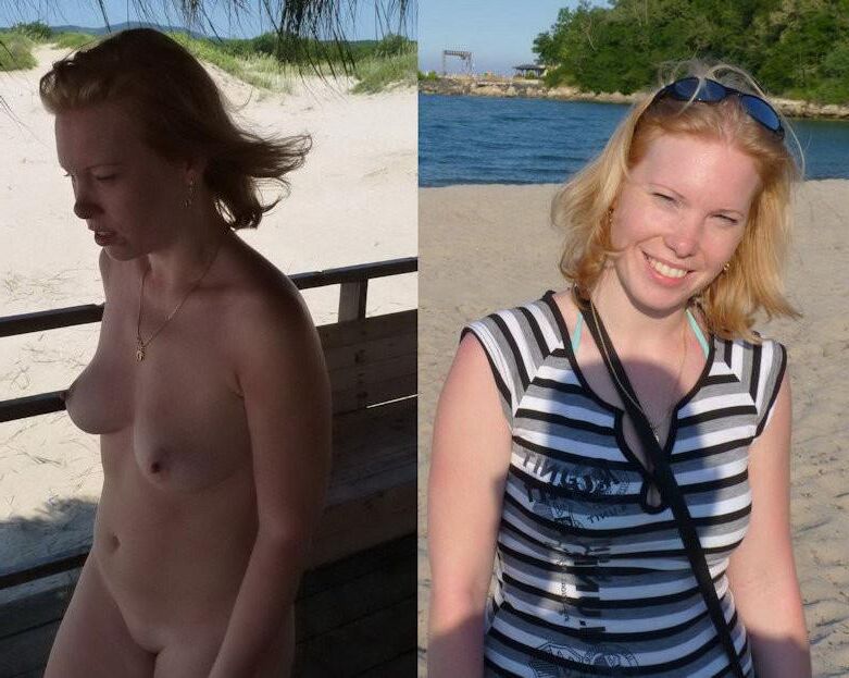 Before and After OMG 