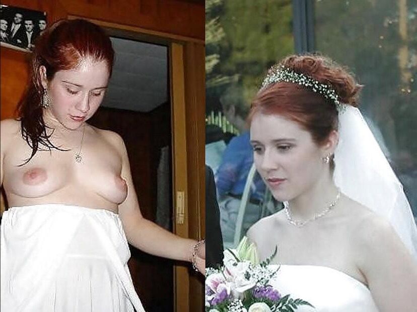 Before and After OMG 