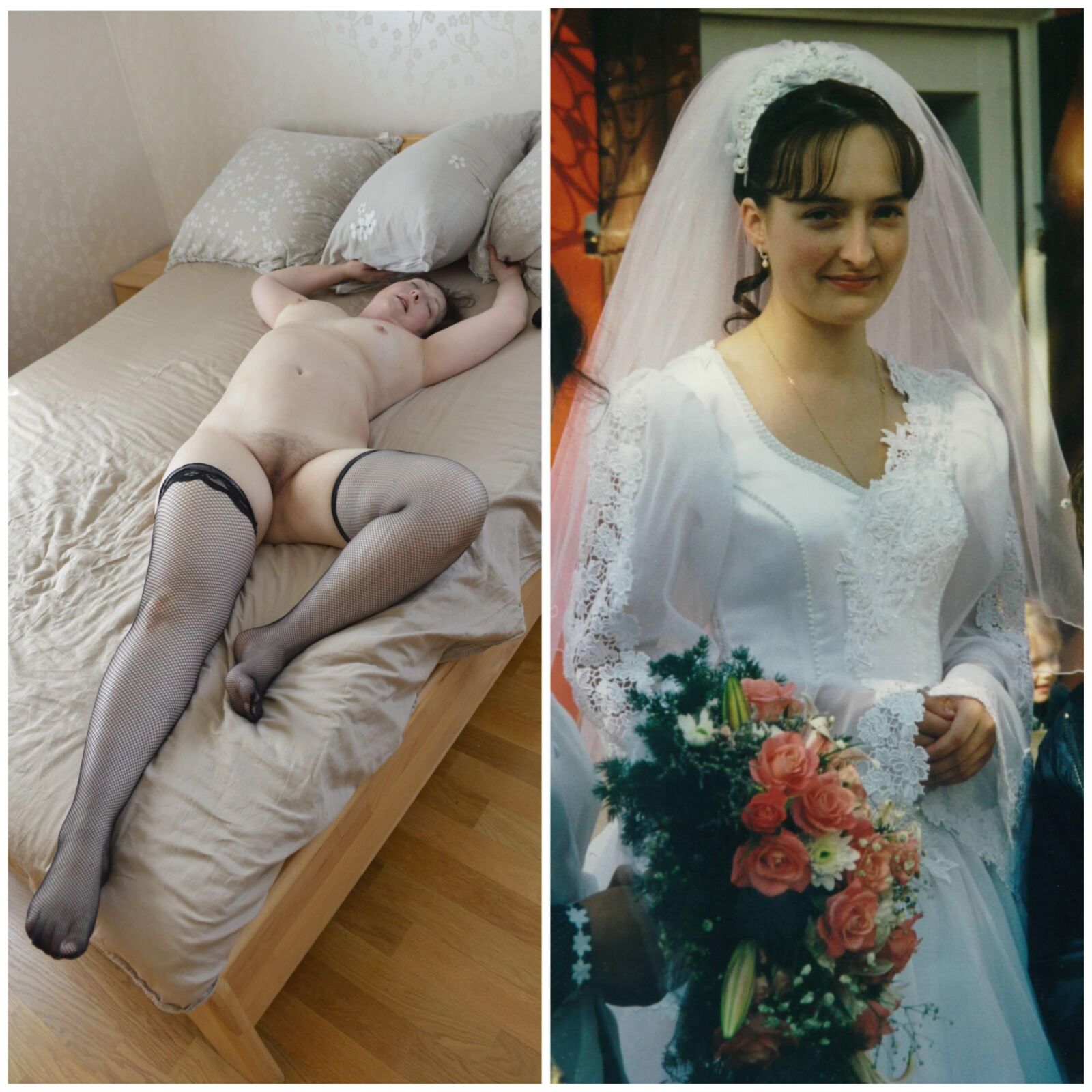 Before and After OMG 
