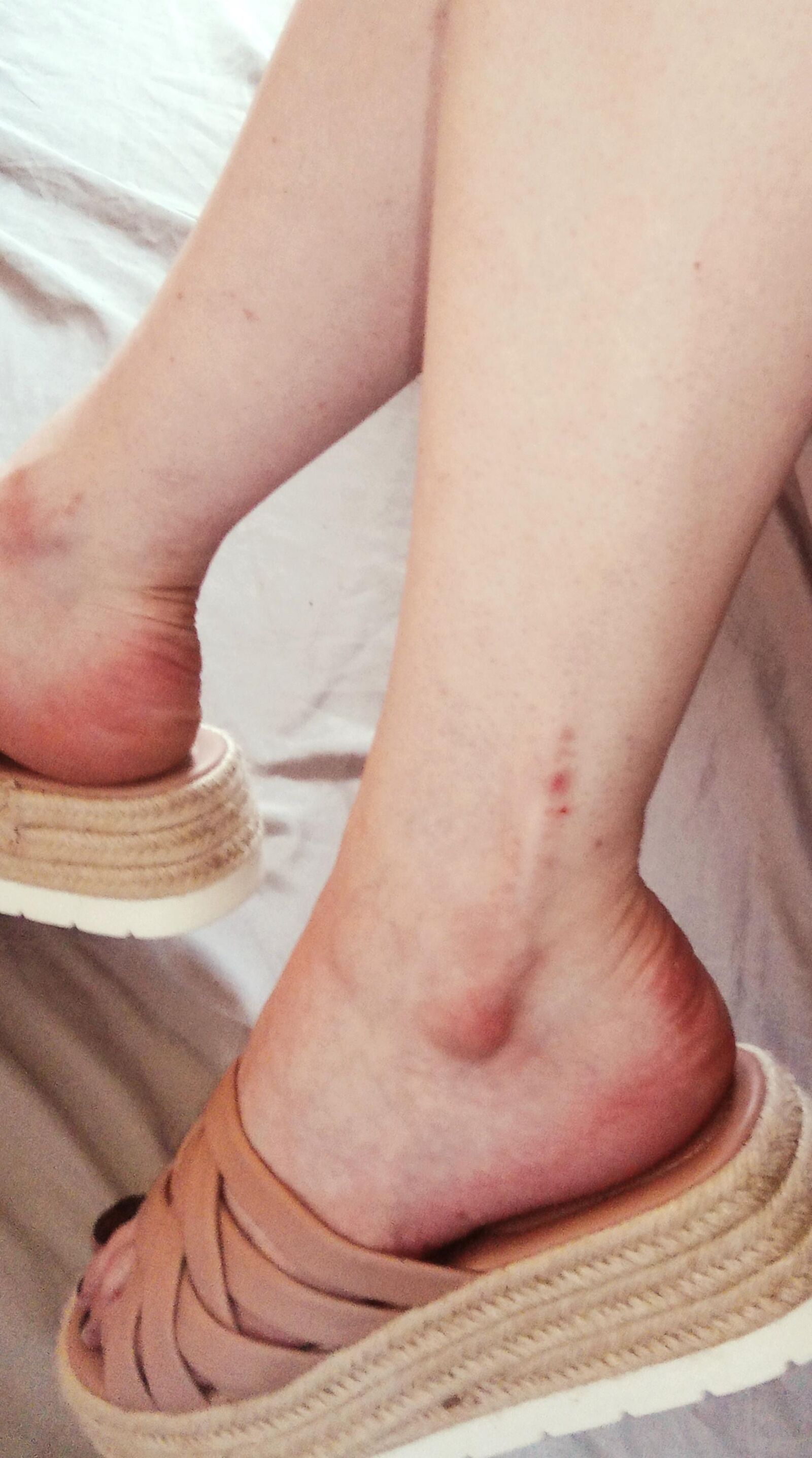 My feet [Emma feet]