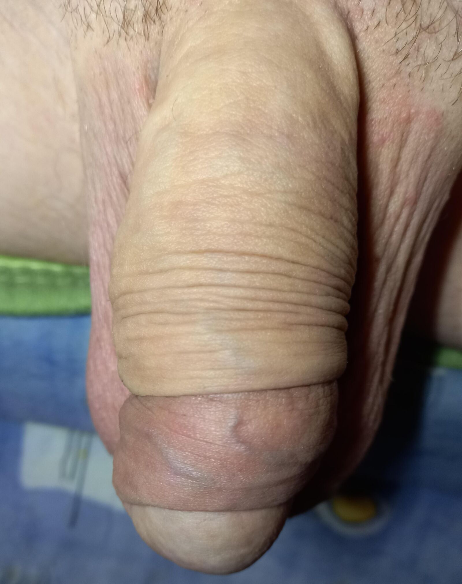 Huge penis
