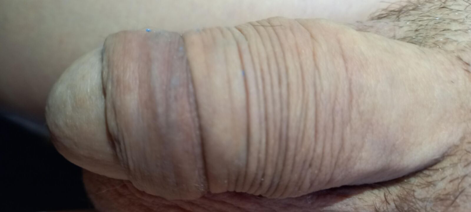 Big penis