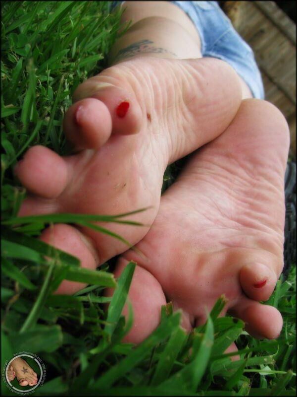  Legs, Feet, and Toe