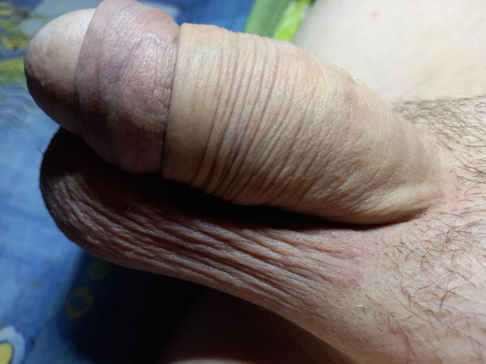 Huge penis