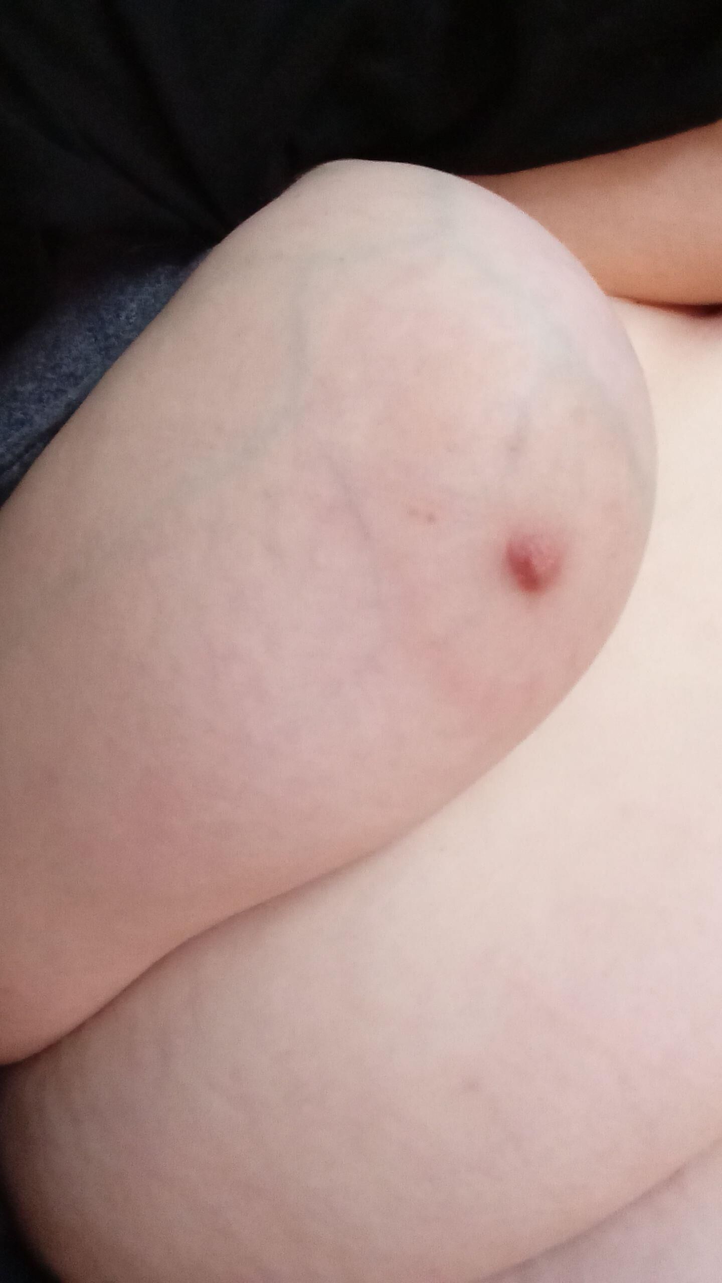 元婚約者