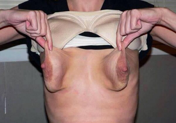 Ugly Saggy