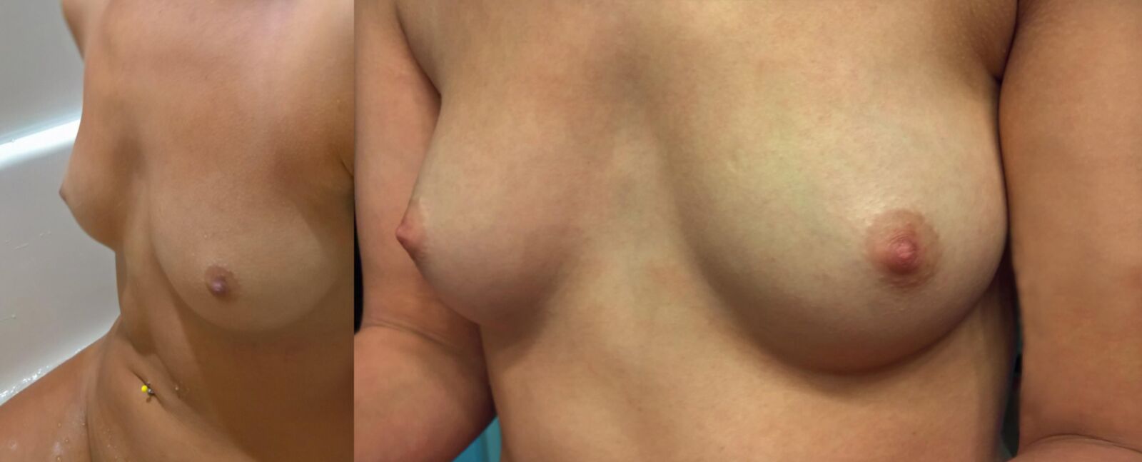 Nude Leaks 