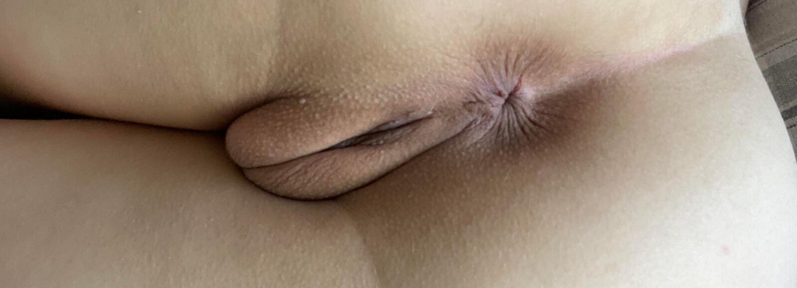 肛門
