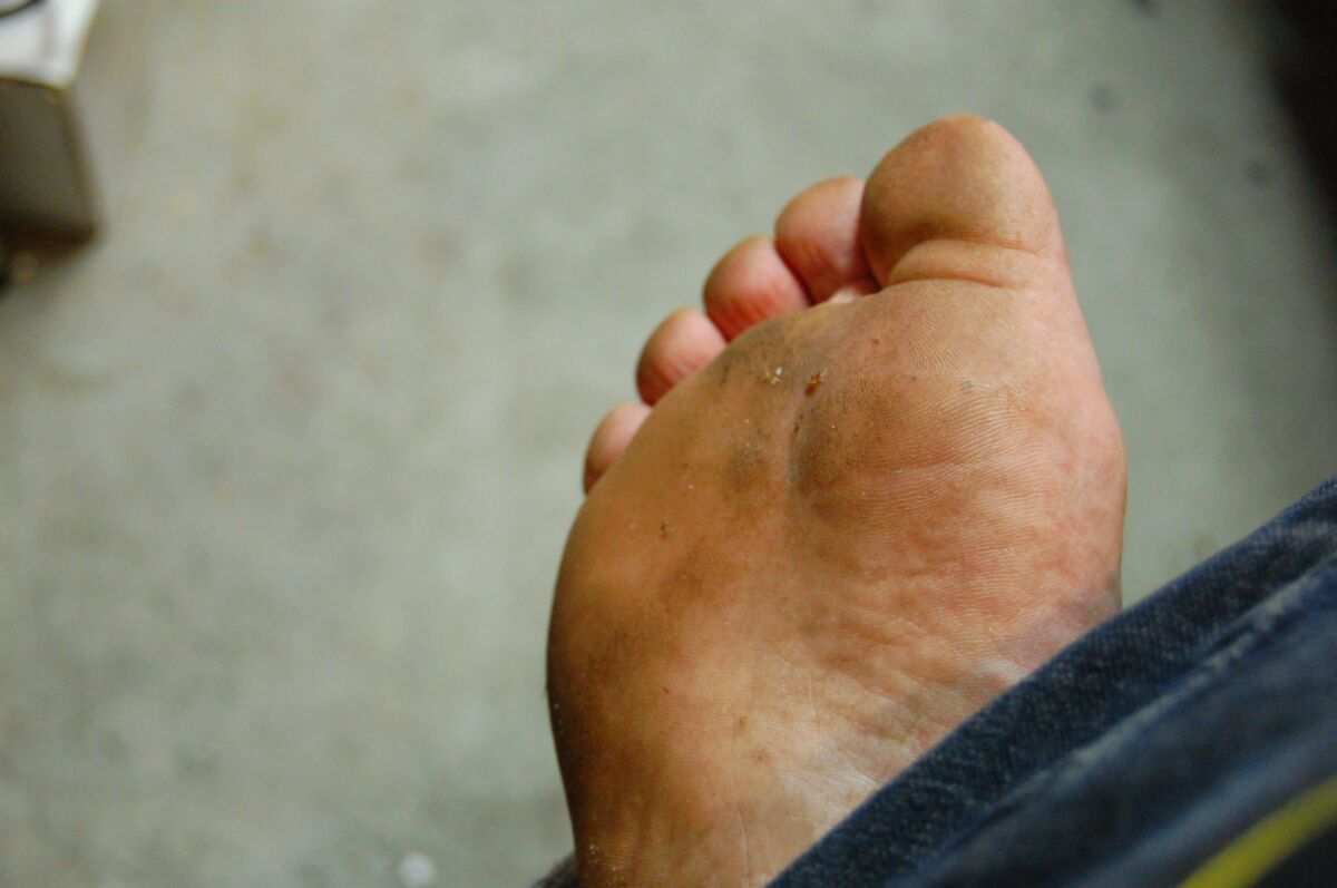 ¡Adelante, corríjate en mis pies sucios!