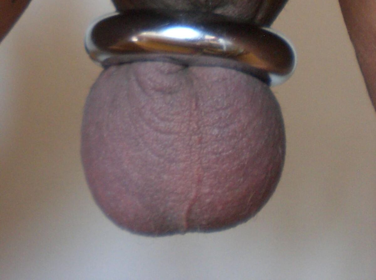 my balls
