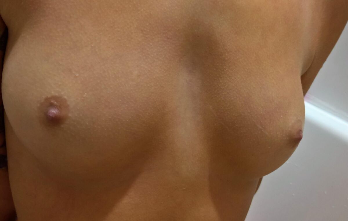 Fugas desnudas
