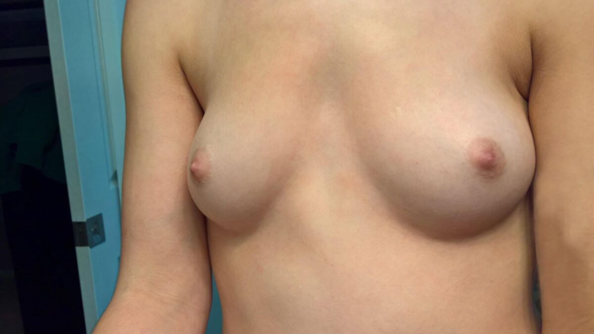Fugas desnudas