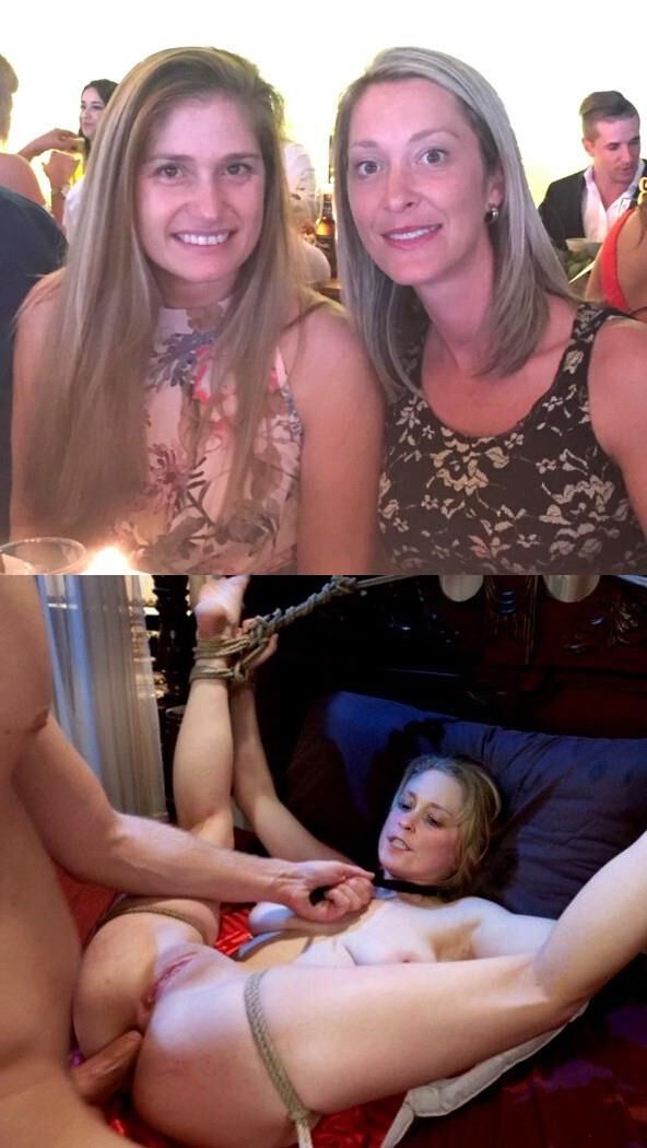 exposed GFs