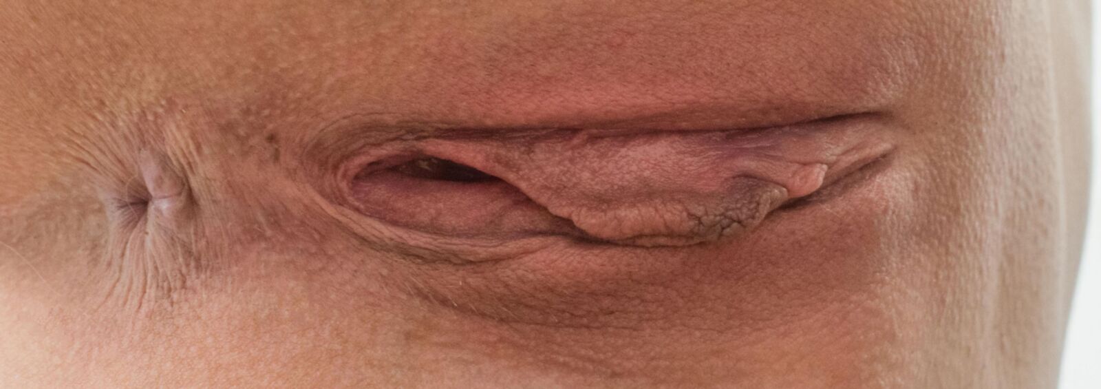 anus 