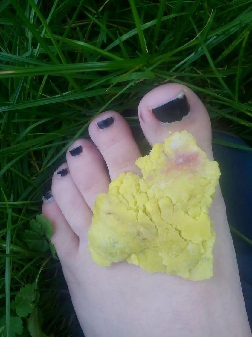 Mis pies y más
