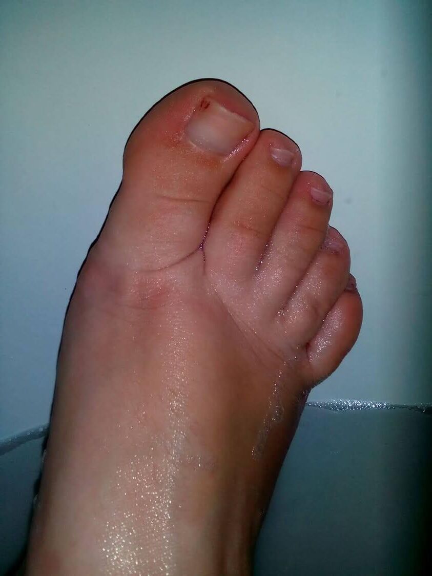 Mis pies y más