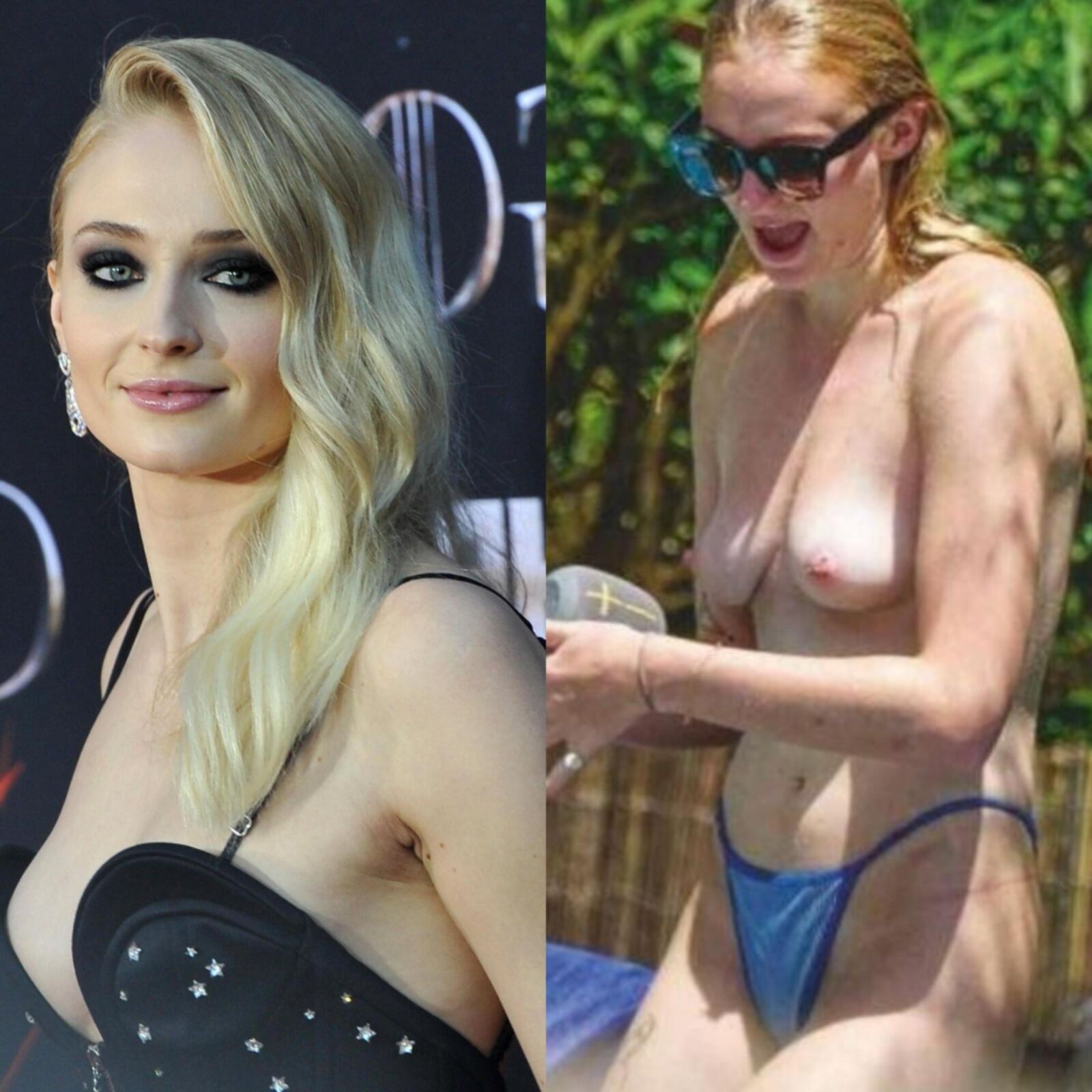 Dressed Undressed Gallery 